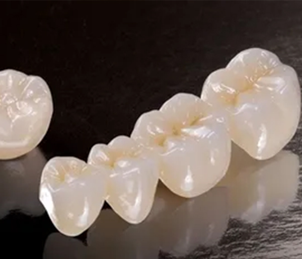 Porcelain Crown & Bridge